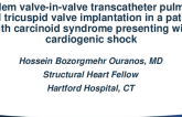 Tandem valve-in-valve transcatheter pulmonic and tricuspid valve implantation in a patient with carcinoid syndrome presenting with cardiogenic shock