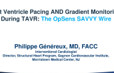 Left Ventricle Pacing AND Gradient Monitoring During TAVR: The OpSens SAVVY Wire