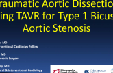 Traumatic Aortic Dissection During TAVR for Type 1 Bicuspid Aortic Stenosis