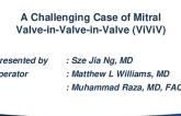 A Challenging Case of Mitral Valve-in-Valve-in-Valve (ViViV)