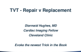 Case 1: Case With Replacement as a Choice (Large Gap, Torrential TR)