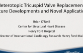 Heterotopic Tricuspid Valve Replacement: Future Developments and Novel Applications