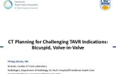 CT Planning for Challenging TAVR Indications:  Bicuspid, Preventing Coronary Obstruction, Valve-in-Valve