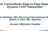 Mitral Transcatheter Edge-to-Edge Repair for Dynamic LVOT Obstruction