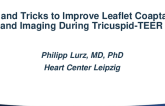 Tips and Tricks to Improve Leaflet Coaptation and Imaging During Tricuspid-TEER