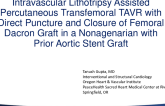 Intravascular Lithotripsy Assisted Percutaneous Transfemoral TAVR with Direct Puncture and Closure of Femoral Dacron Graft in a Nonagenarian with Prior Aortic Stent Graft
