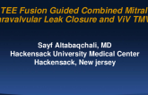 Case: TEE Fusion Guided Combined Mitral Valve Prosthesis Paravalvular Leak Closure and ViV TMVR