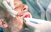 Antibiotics Before Invasive Dental Work Helpful in High-Risk Patients