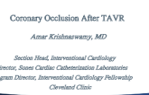 Coronary Occlusion After TAVR