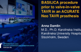 TCT 610: BASILICA procedure prior to valve-in-valve TAVR in an ACURATE Neo TAVR prosthesis
