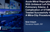 TCT 659: Acute Mitral Regurgitation With Unilateral Left-Sided Pulmonary Edema: A Complication of STEMI Treated Successfully With A Mitra-Clip Procedure