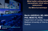 TCT 617: Mitral leaflet cutting before transcatheter mitral valve replacement -  the Mitra-Cut technique.
