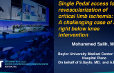 TCT 647: Single Pedal access for revascularization of critical limb ischemia:  A challenging case of a unilateral pedal-to-pedal intervention