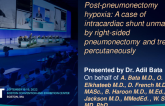 TCT 804: Post-pneumonectomy hypoxia: A Case of intracardiac shunt unmasked by right-sided pneumonectomy and treated percutaneously