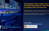 TCT 650: Transcatheter Edge-to-Edge Valve Repair for Torrential Atrioventricular Valve Regurgitation in a Patient With Left Isomerism