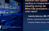 TCT 773: Femoral vein rupture leading to intraperitoneal bleeding during the Mitra-Clip procedure: A case report