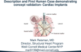 Two-Stage Transcatheter Tricuspid Annuloplasty: Technology Description and First Human Case Demonstrating Concept Validation (Cardiac Implants)