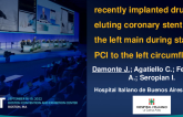 TCT 785: Unintentional Extraction of a Recently Implanted Drug Eluting Coronary Stent From the Left Main During Staged PCI to the Left Circumflex