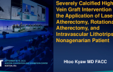 TCT 728: Successful Complex and Severely Calcified High-Risk Vein Graft Intervention With the Application of Laser Atherectomy, Rotational Atherectomy, and Intravascular Lithotripsy in A Nonagenarian Patient