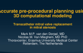 TCT 741: Accurate pre-procedural planning using 3D computational modeling in transcatheter mitral valve replacement in mitral stenosis.