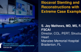 Iliocaval Stenting and Reconstructions With Extreme Case Examples