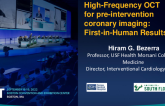 High Frequency-OCT (HF-OCT) for Preintervention Coronary Imaging: First-in-Human Results