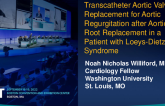 TCT 747: Transcatheter Aortic Valve Replacement for Aortic Regurgitation after Aortic Root Replacement in a Patient with Loeys-Dietz Syndrome