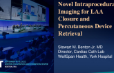 TCT 613: Novel Intraprocedural Imaging for LAA Closure and Percutaneous Device Retrieval