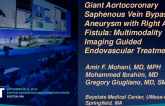 TCT 629: Giant Aortocoronary Saphenous Vein Bypass Graft Aneurysm with Right Atrial Fistula: Multimodality Imaging Guided Endovascular Treatment