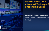 Valve-in-Valve TAVR:  Advanced Technique for Challenging Cases