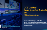 TCT 658: A Case of Challenging LM Bifurcation treated by nano Inverted T stenting (NIT) under OCT Guidance