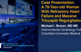 Case Presentation: A 79 Year-old Woman With Refractory Heart Failure and Massive Tricuspid Regurgitation