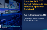 TCT 699: Complex RCA CTO Solved Retrograde via a Tortuous Epicardial Collateral