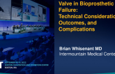 Valve in Bioprosthetic Mitral Failure:  Technical Considerations, Outcomes, and Complications
