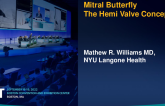 Mitral Butterfly: An Upgrade in Transcatheter Mitral Repair (AVVie)