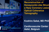 TCT 822: Three-Dimensional Reconstruction of Honeycomb-Like Structure of a Hazy Coronary Lesion by Optical Coherence Tomography