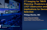 CT Imaging for TMVR Planning: Predictors of LVOT Obstruction and Implications for Device Selection