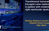 TCT 689: Transfemoral transcathetertricuspid valve replacement in a patient with moderate right ventricular dysfunction