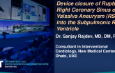 TCT 742: Device closure of Ruptured Right Coronary Sinus of Valsalva Aneurysm (RSOV) in the subpulmonic right ventricle in an elderly female