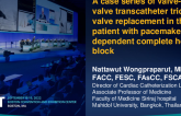 TCT 620: Valve-in-valve transcatheter tricuspid valve replacement in the patient with pacemaker-dependent complete heart block