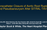 TCT 614: Transcatheter Closure of Aortic Root Rupture and Pseudoaneurysm After SITRAL-TAVR 