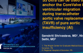TCT 770: S3 Ultra can be used to anchor the CoreValve in ventricular migration during transcatheter aortic valve replacement in pure aortic insufficiency
