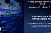 TCT 671: A Rare Complication During TAVI. Valve (and STENT) for Life.