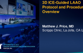 3D ICE guided LAAO protocol and procedural overview
