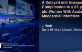 TCT 683: A Delayed and Unexpected Complication in a 67-year-old Women With Acute Myocardial Infarction