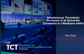 TCT 772: Simultaneous Thrombotic Occlusion of all Epicardial Coronaries in a Marijuana addictSimultaneous Thrombotic Occlusion of all Epicardial Coronaries in a Marijuana addict