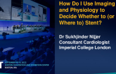 How Do I Use Imaging and Physiology to Decide Whether to (or Where to) Stent?