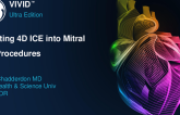 Integrating 4D ICE into Mitral Procedures