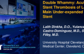 TCT 648: Double Whammy – Acute In-stent Thrombosis of Left Main Under-Expanded Stent