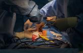 Heart Transplantation After Circulatory Death Gives ‘Encouraging’ Results
